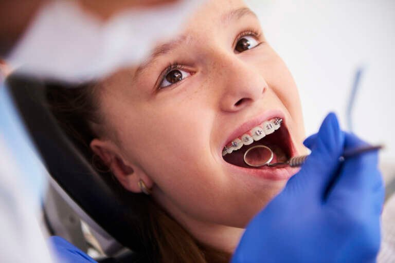 Braces & Orthodontics