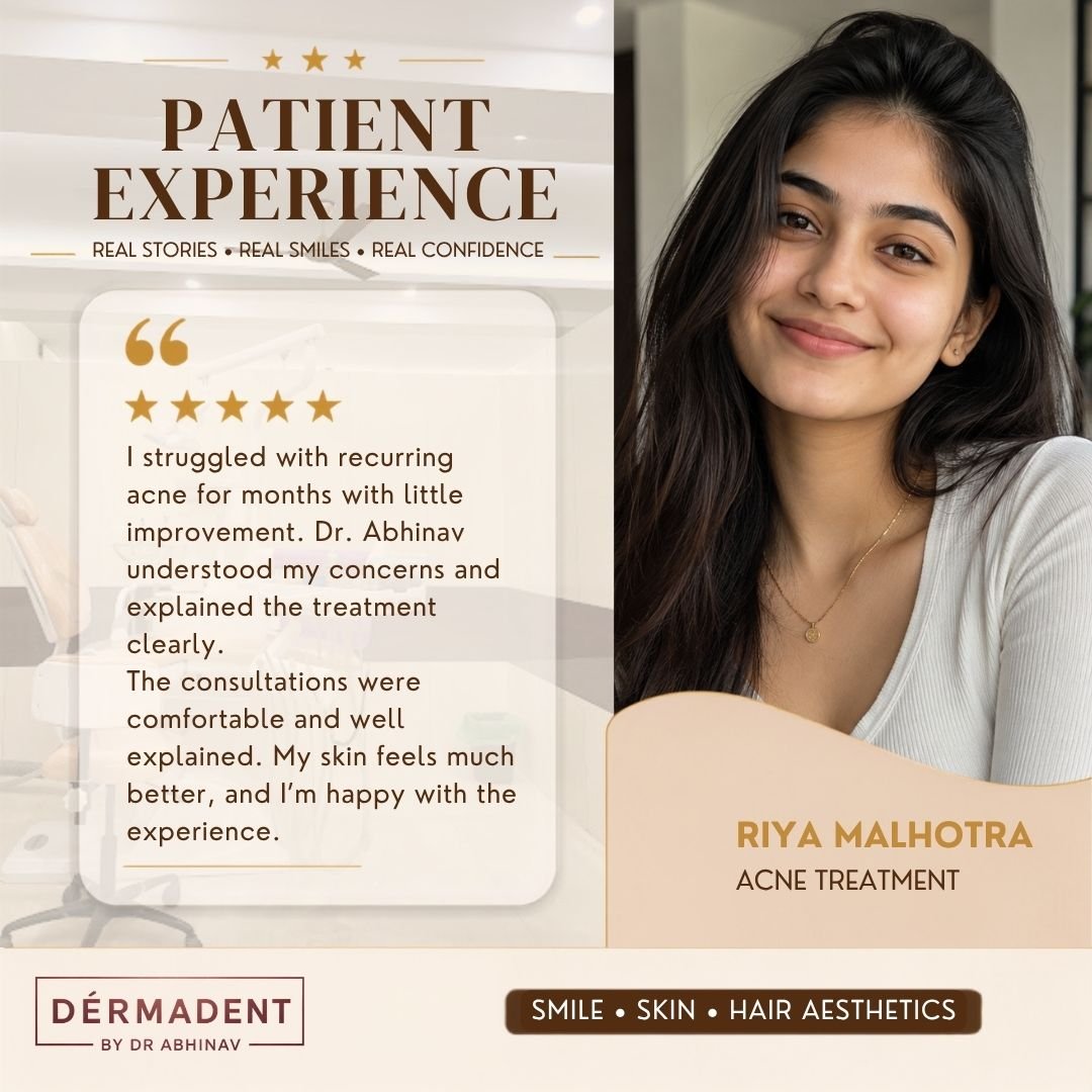 acne-treatment-patient-review-dermadent.jpg