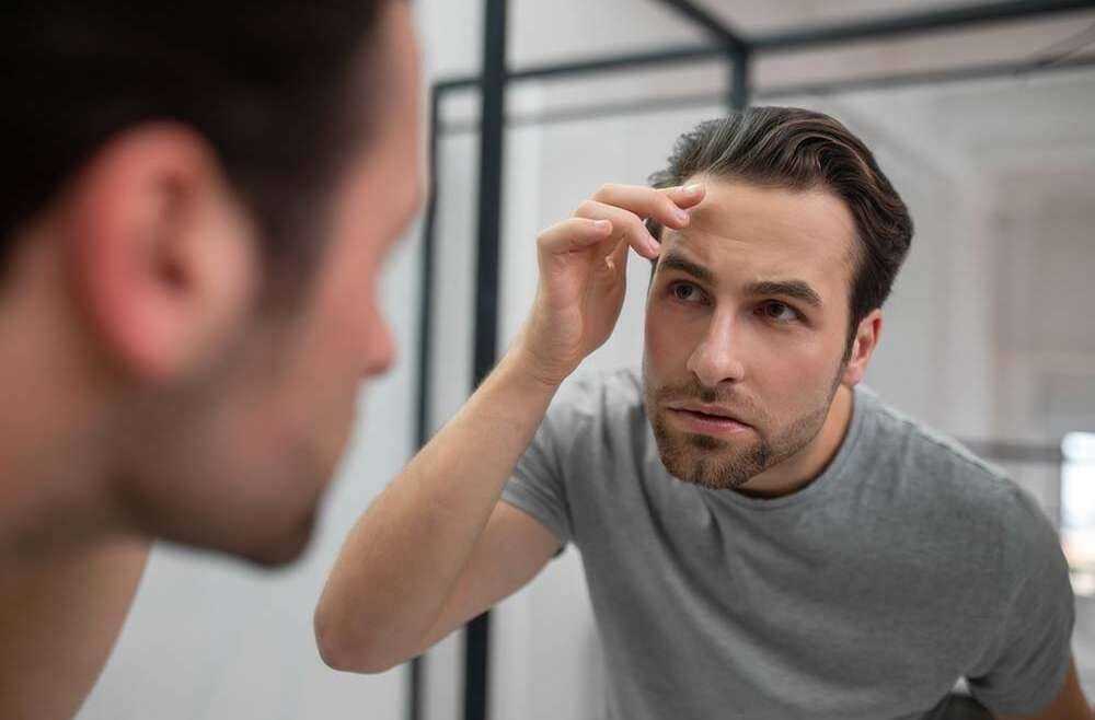 Man checking early hair thinning and receding hairline in mirror.