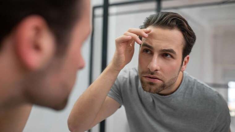 Man checking early hair thinning and receding hairline in mirror.
